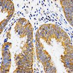 PIBF1 Polyclonal Antibody