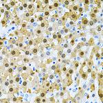 PIBF1 Antibody in Immunohistochemistry (Paraffin) (IHC (P))