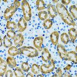 PRDX3 Antibody in Immunohistochemistry (Paraffin) (IHC (P))