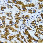 PRDX3 Antibody in Immunohistochemistry (Paraffin) (IHC (P))