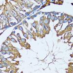 PRDX3 Antibody in Immunohistochemistry (Paraffin) (IHC (P))