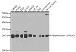 PRDX3 Antibody in Western Blot (WB)