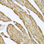 TPM2 Antibody in Immunohistochemistry (Paraffin) (IHC (P))
