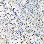 SUMO4 Antibody in Immunohistochemistry (Paraffin) (IHC (P))