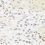 SUMO4 Polyclonal Antibody