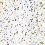 SUMO4 Antibody in Immunohistochemistry (Paraffin) (IHC (P))