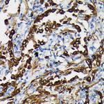 SFTPA1 Polyclonal Antibody