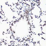 H3R17me1 Antibody in Immunohistochemistry (Paraffin) (IHC (P))