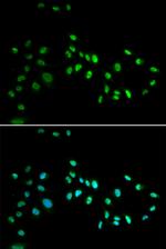 DNMT3A Polyclonal Antibody
