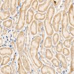 NLK Antibody in Immunohistochemistry (Paraffin) (IHC (P))