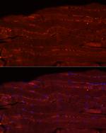 FBXO32 Antibody in Immunohistochemistry (Paraffin) (IHC (P))