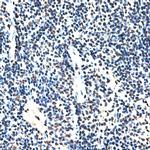 RBM17 Antibody in Immunohistochemistry (Paraffin) (IHC (P))