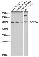 GABPB2 Polyclonal Antibody