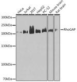 ARHGAP5 Antibody in Western Blot (WB)