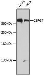 NG2 Antibody in Western Blot (WB)