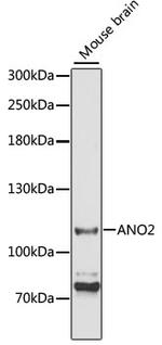 TMEM16B Antibody in Western Blot (WB)