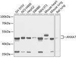 Annexin A7 Polyclonal Antibody