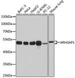 RhoGAP Antibody in Western Blot (WB)