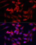 Collagen III Antibody in Immunocytochemistry (ICC/IF)