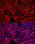 Carboxypeptidase A1 Polyclonal Antibody