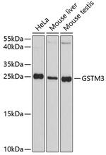GSTM3 Polyclonal Antibody