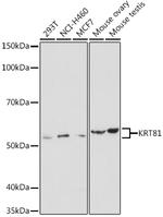 KRT81 Polyclonal Antibody