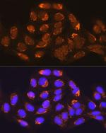 MUT Polyclonal Antibody