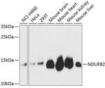 NDUFB2 Polyclonal Antibody