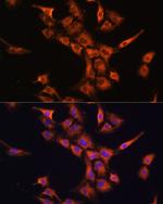PFDN5 Antibody in Immunocytochemistry (ICC/IF)
