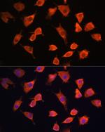 PFDN5 Polyclonal Antibody