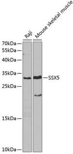 SSX5 Antibody in Western Blot (WB)