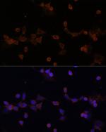 UBE2L3 Antibody in Immunocytochemistry (ICC/IF)
