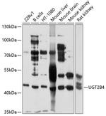 UGT2B4 Polyclonal Antibody