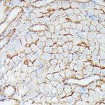 IFITM1 Polyclonal Antibody