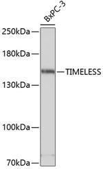 TIMELESS Polyclonal Antibody