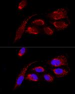 ATP5H Antibody in Immunocytochemistry (ICC/IF)