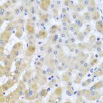 PCID1 Polyclonal Antibody