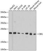 Calmyrin Polyclonal Antibody