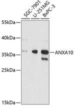 Annexin A10 Polyclonal Antibody