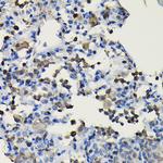 COTL1 Antibody in Immunohistochemistry (Paraffin) (IHC (P))