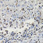 COTL1 Polyclonal Antibody