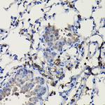 COTL1 Antibody in Immunohistochemistry (Paraffin) (IHC (P))