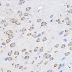 PTPN23 Polyclonal Antibody