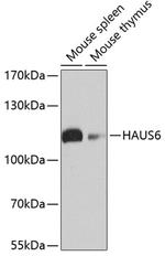 HAUS6 Polyclonal Antibody