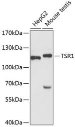 TSR1 Polyclonal Antibody