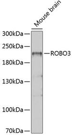 ROBO3 Polyclonal Antibody
