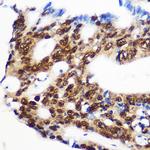 RBM15 Polyclonal Antibody