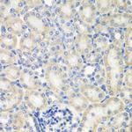 NAT13 Antibody in Immunohistochemistry (Paraffin) (IHC (P))