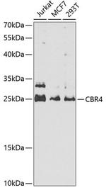 CBR4 Antibody in Western Blot (WB)