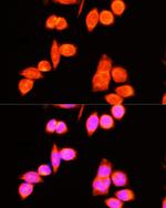 DNAJC19 Polyclonal Antibody